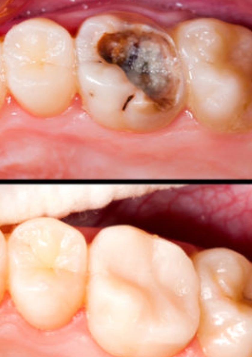 Dentisterie Générale